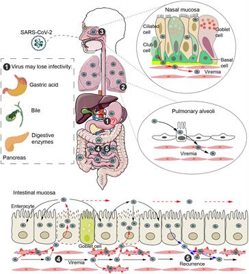 Intestinal Damage in COVID-19: SARS-CoV-2 Infection and Intestinal Thrombosis